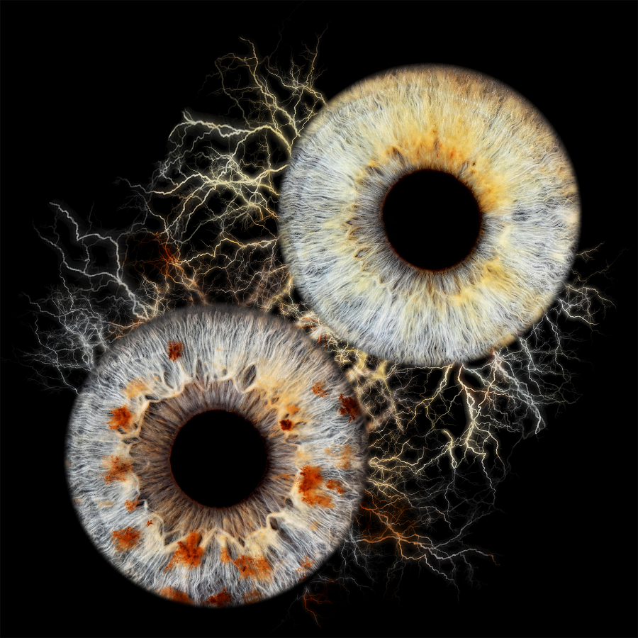 Irisfotografie - Ihr Auge als Fine Art Print